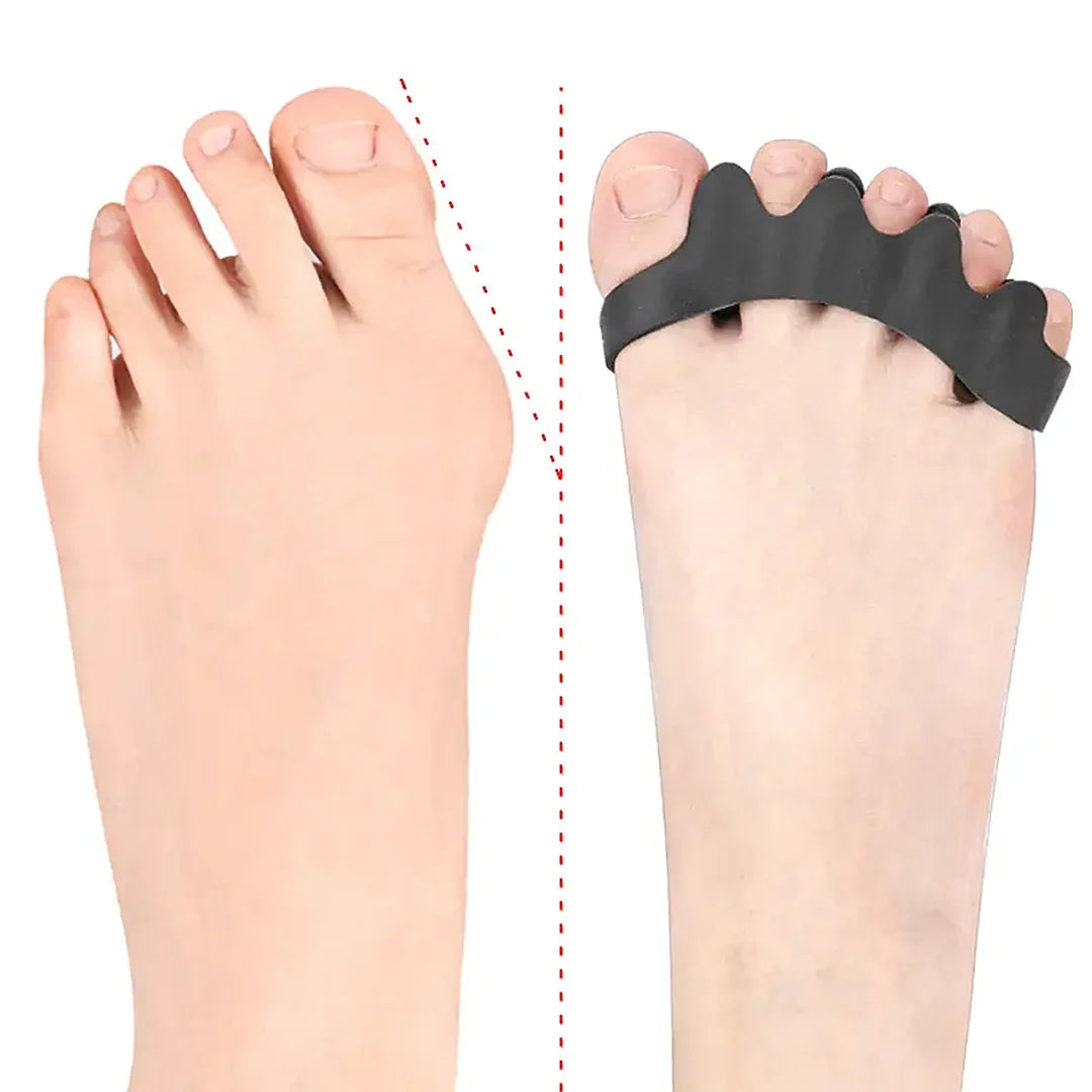 Corrección juanetes con zapatos ergonómicos — separadores Sowilo Advance para pie barefoot Chile